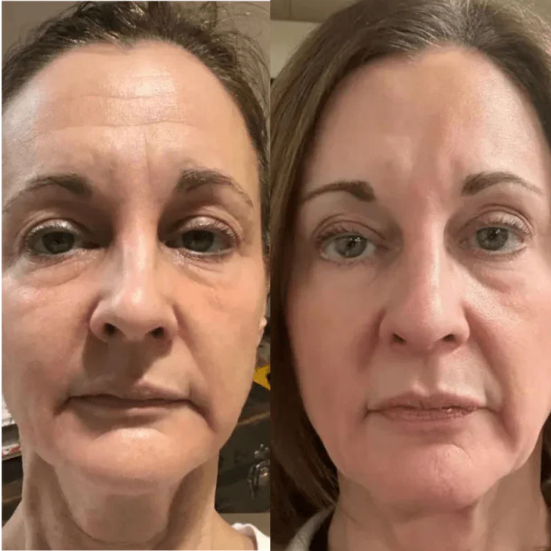Lucenova – Die LED-Therapiemaske für strahlende Haut