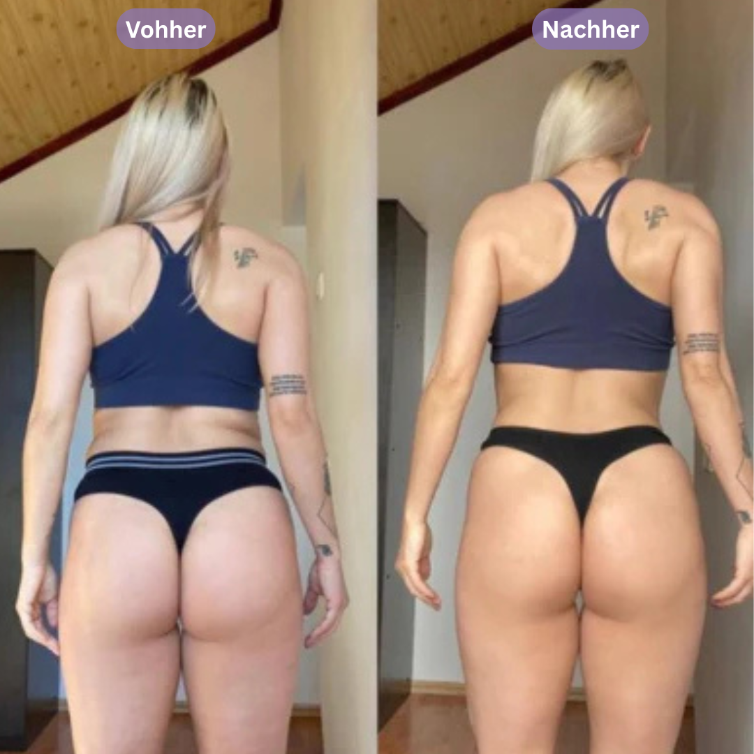 SIKIFY – Schröpfen für glattere Haut